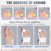 Feet Finger Corrector